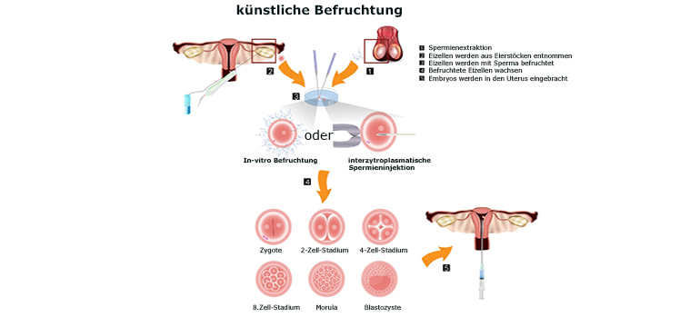 shutterstock_123056011 GRei