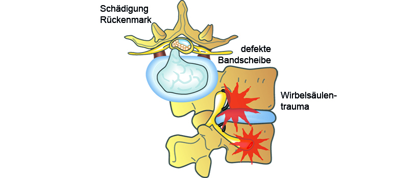 shutterstock_88868101vikici