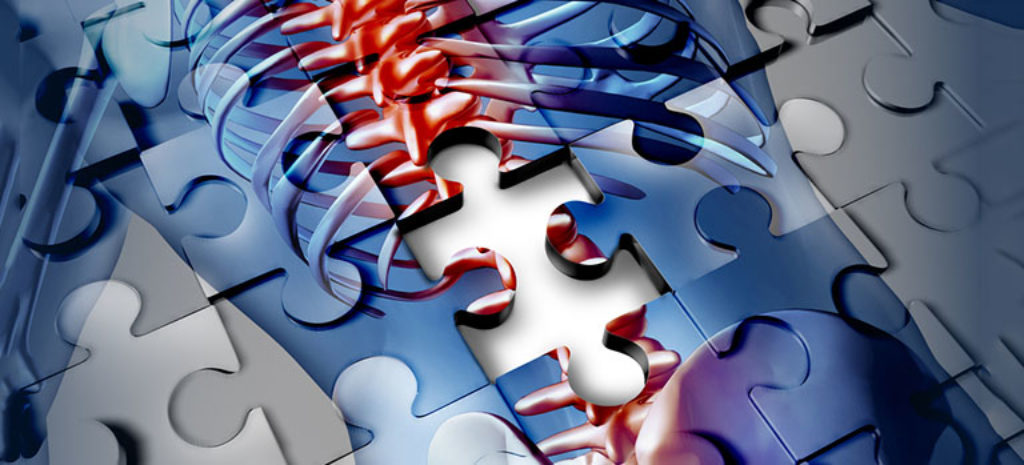 Das Symbolbild für eine Querschnittlähmung zeigt in blau und rot eine menschliche Wirbelsäule, Brustkorb, Armknochen und andere Knoche in einem menschlichen Umriss - dargestellt als Puzzle. Kurz unterhalb des Brustkorbs fehlt ein Puzzleteil, die Wirbelsäule ist dadurch nicht komplett.