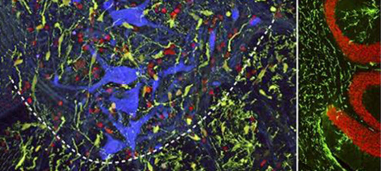 Subpial Injection histograph-marsala-subpialinjections, 2020 Quelle: Pressemitteilung ...