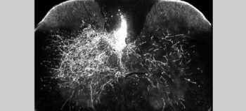 Medikament gegen Nervenschmerzen kann Regeneration neuronaler Schaltkreise fördern